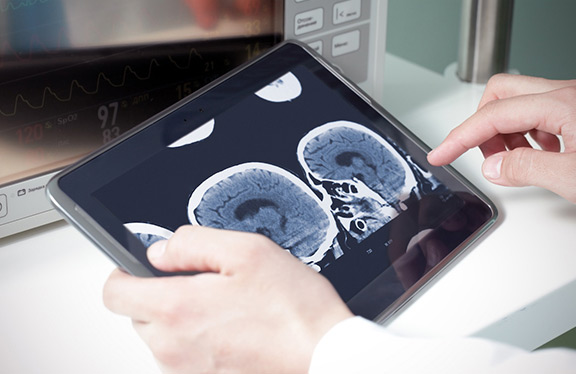 CT scan