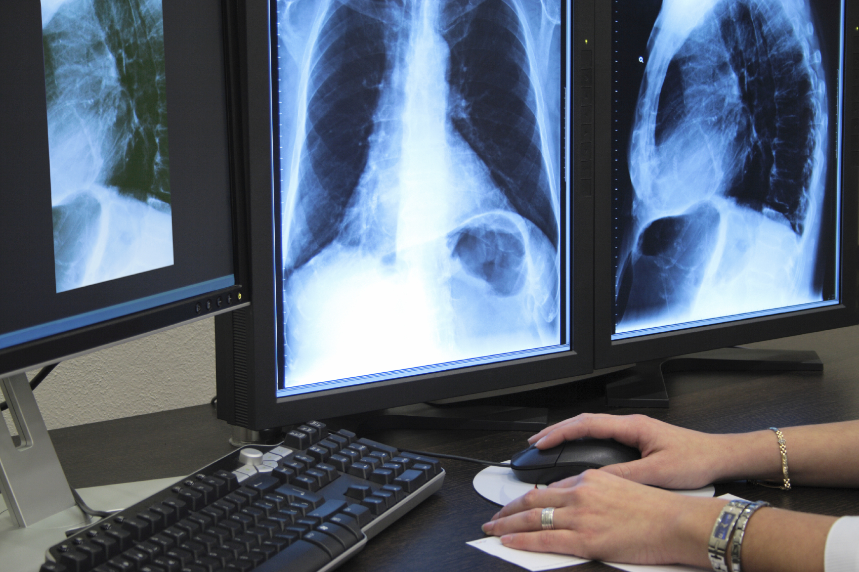 x-ray