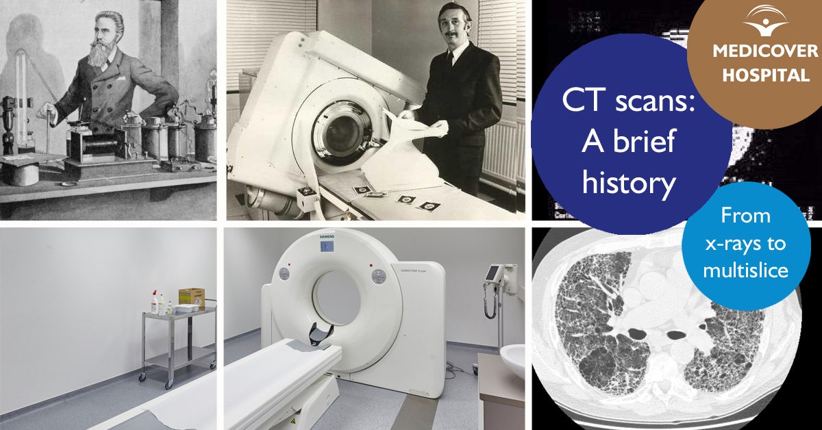 History of CT - - Medicover Hospital - Hospital affordable surgery in Budapest, Hungary